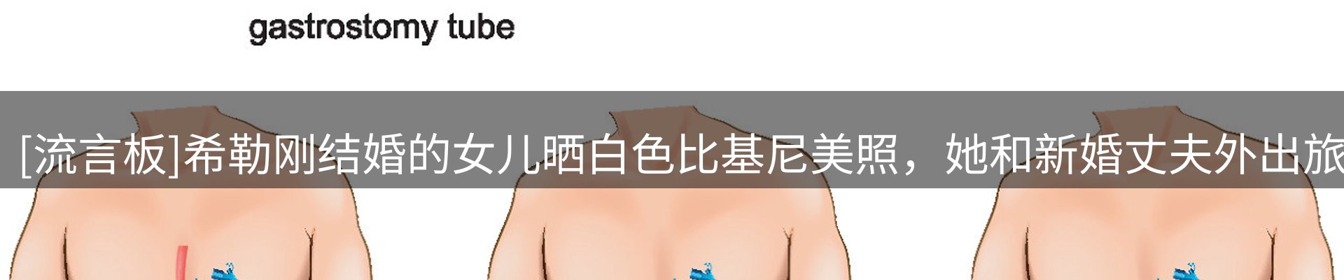 新闻播送